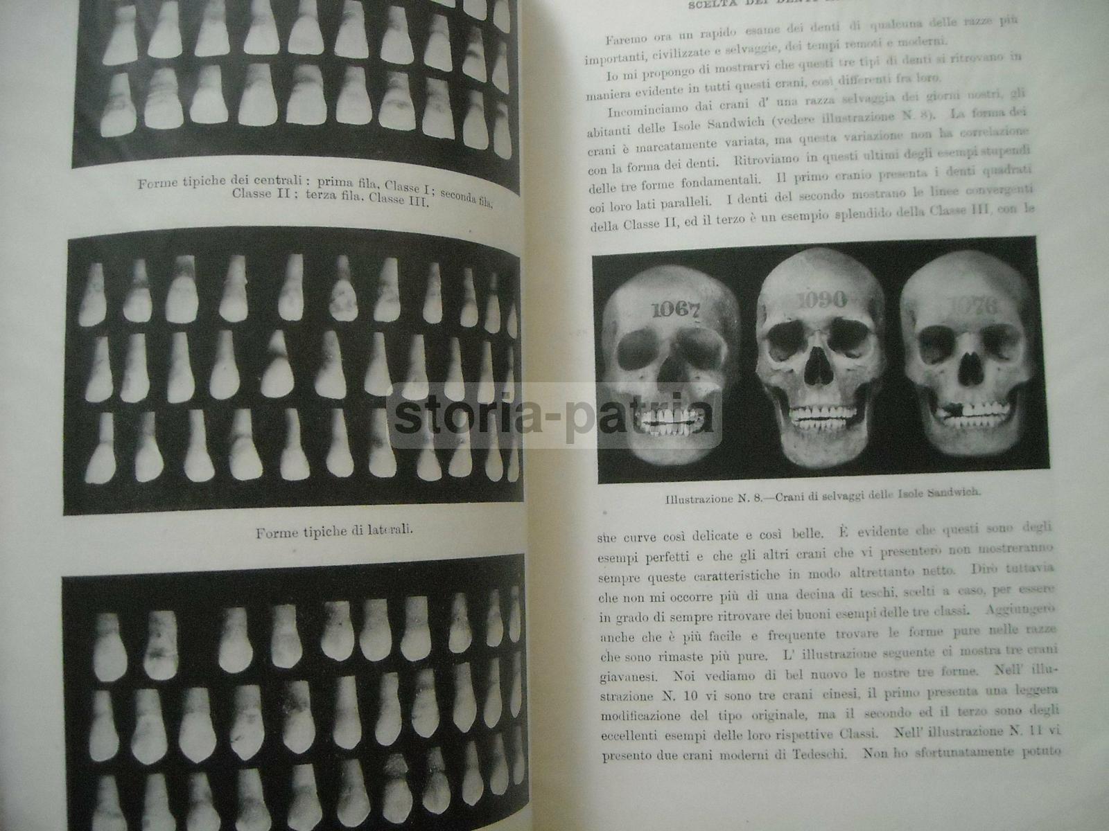 Medicina, Odontoiatria, Dentiere, Denti Artificiali, Antropologia E Dentatura Umana immagine 3