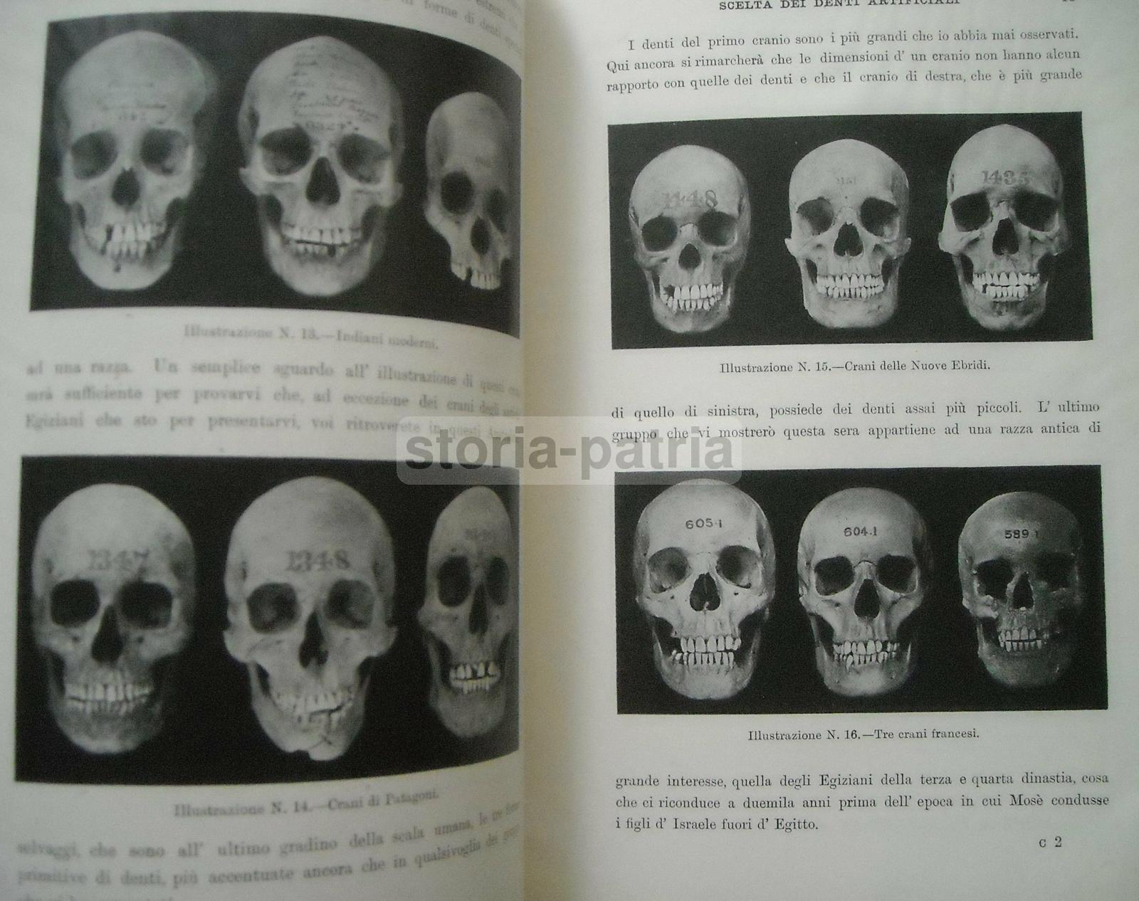 Medicina, Odontoiatria, Dentiere, Denti Artificiali, Antropologia E Dentatura Umana immagine 4