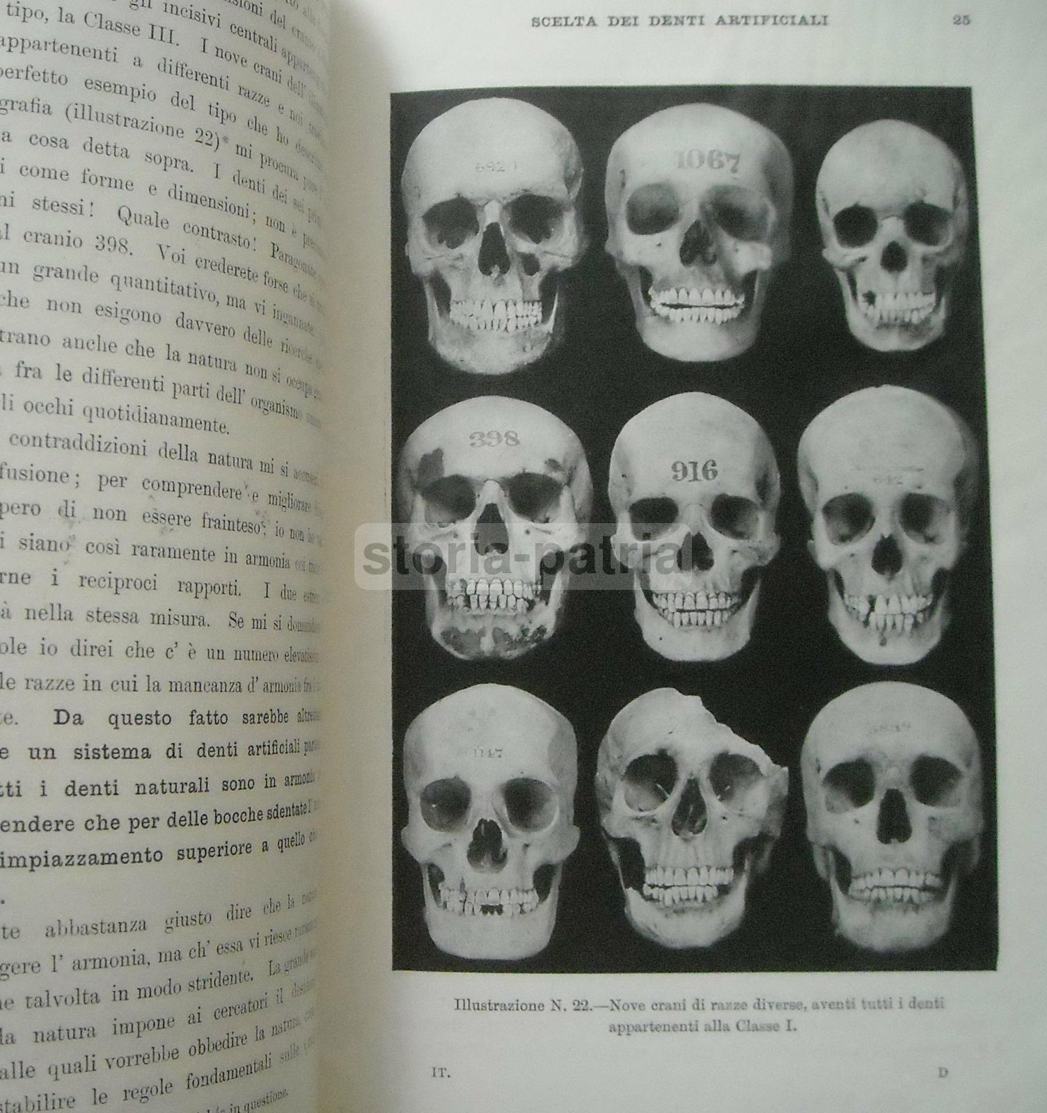 Medicina, Odontoiatria, Dentiere, Denti Artificiali, Antropologia E Dentatura Umana immagine 6